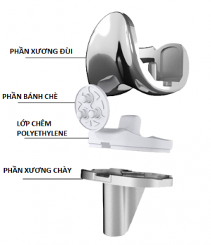 Phẫu thuật thay khớp gối nhân tạo